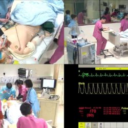 Scenario practice of intubation